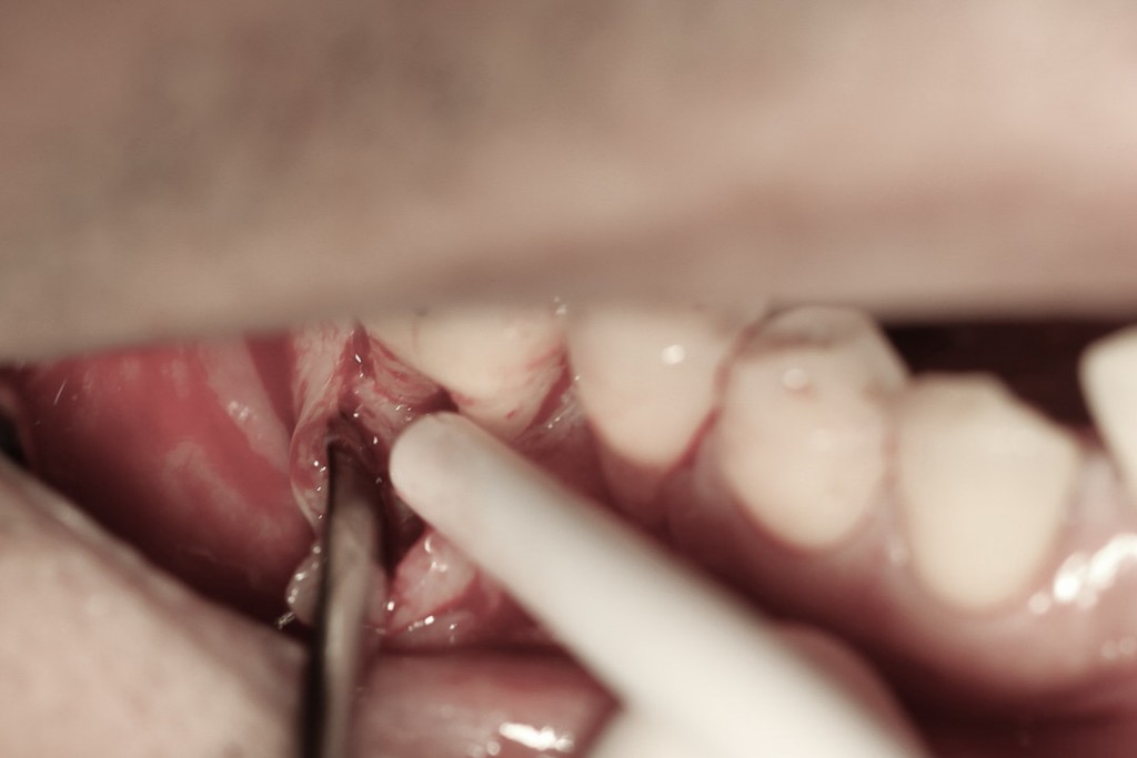 surgery-1-02