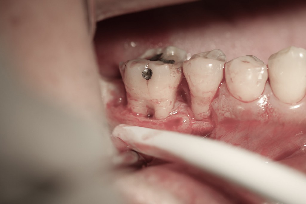 surgery-1-03