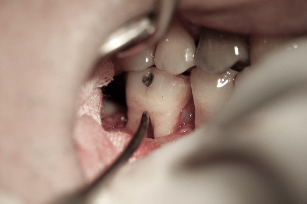 surgery-1-04