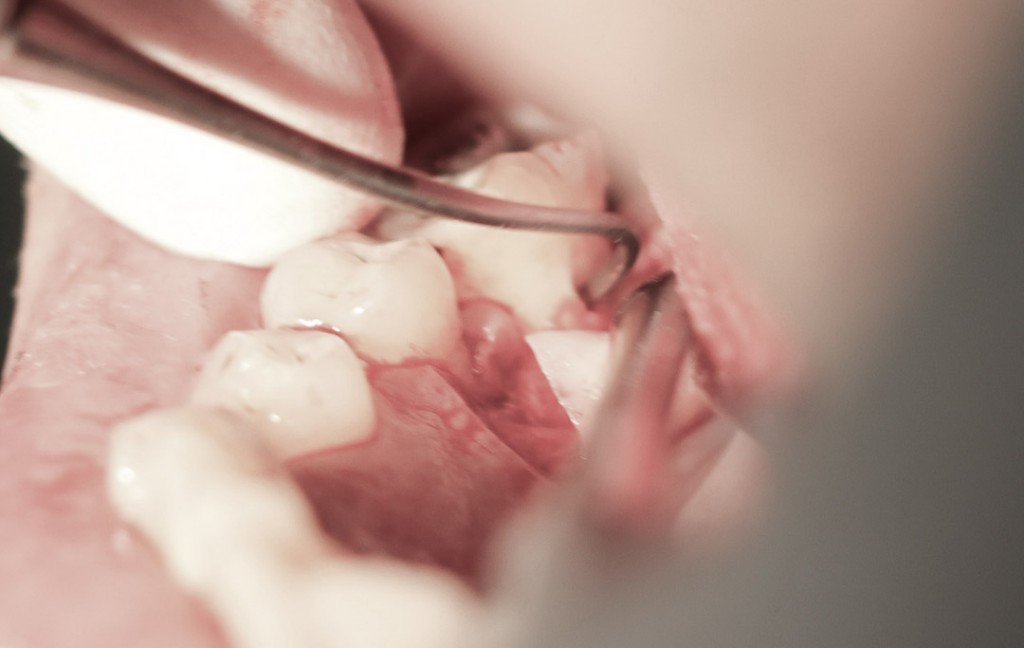 surgery-1-05