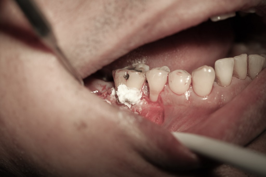 surgery-1-09