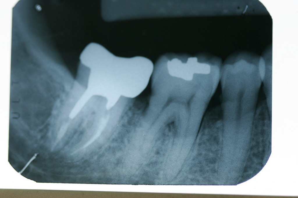 surgery-2-02