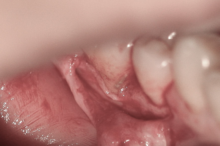 surgery-2-05