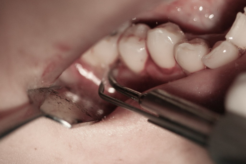surgery-2-06