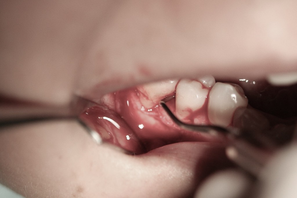 surgery-2-07
