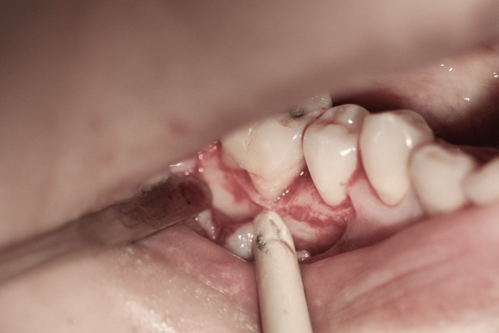 surgery-2-08