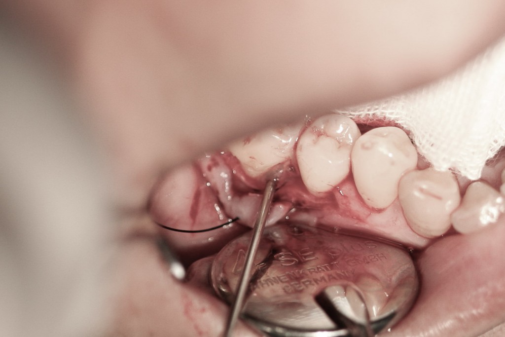 surgery-2-10