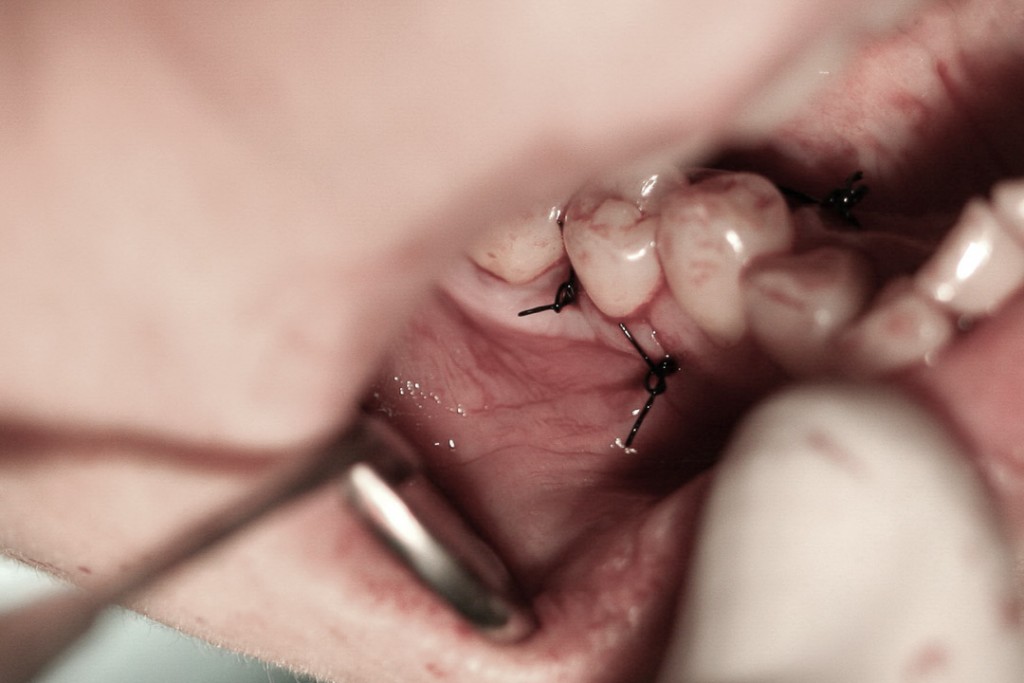 surgery-2-11