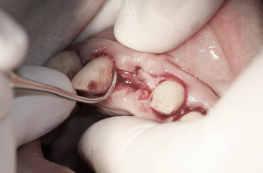 surgery-3-03