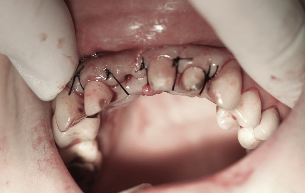 surgery-3-04