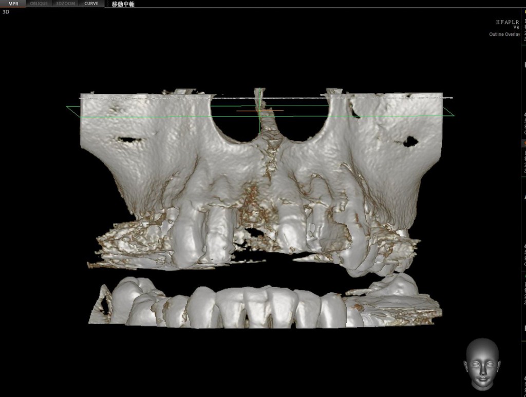 surgery-3-06