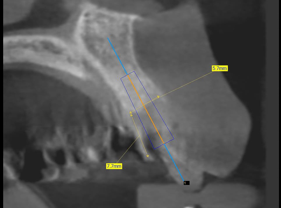 surgery-3-08