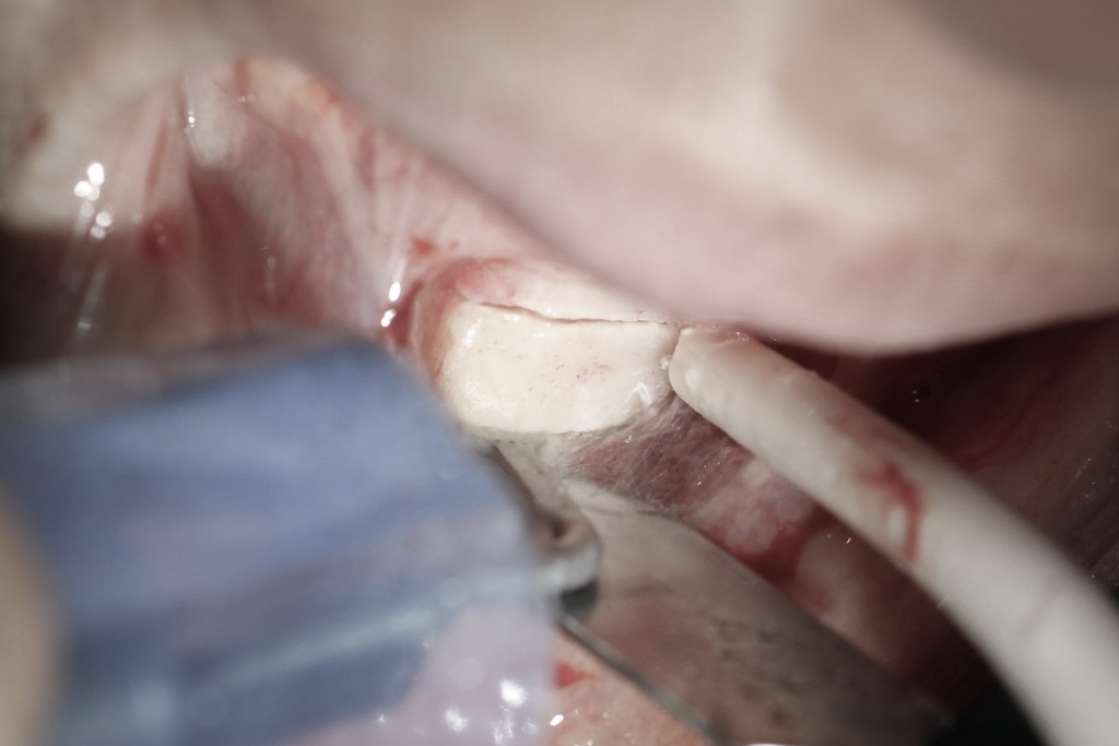 surgery-3-09