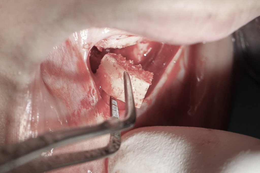 surgery-3-10