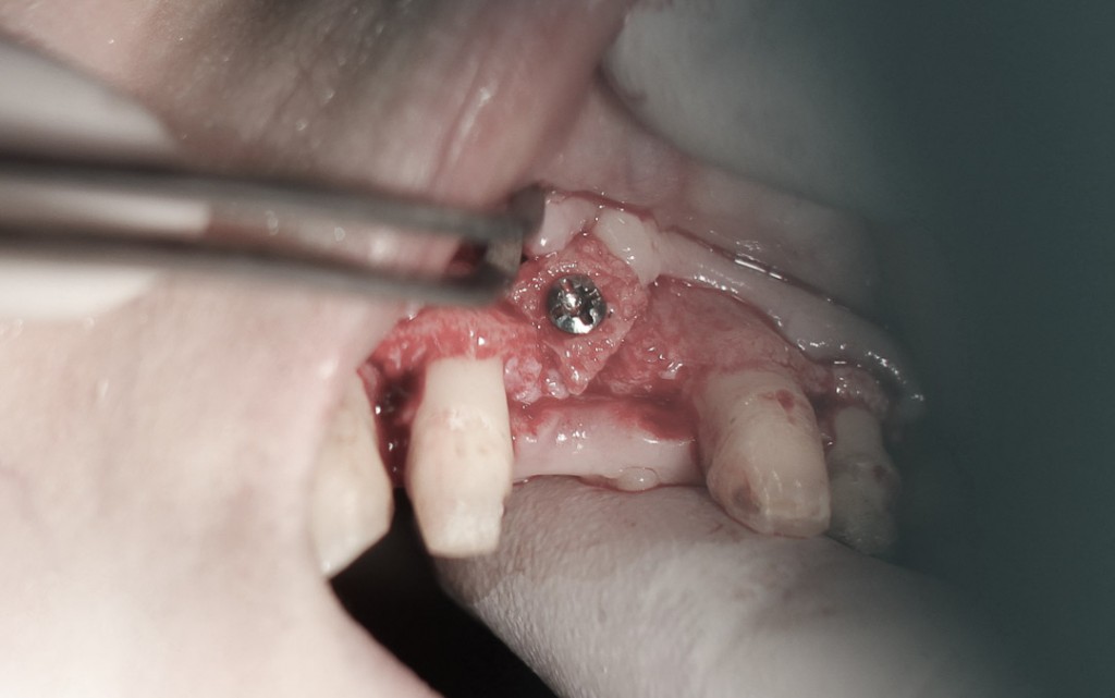 surgery-3-11