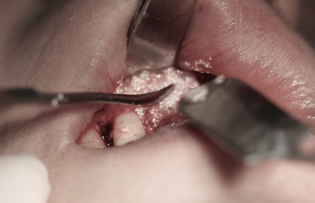 surgery-3-12