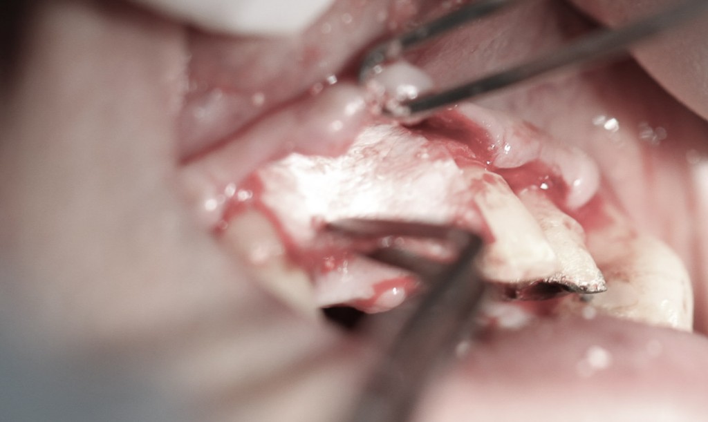 surgery-3-13