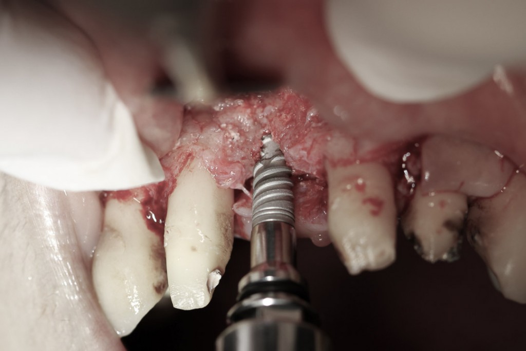 surgery-3-15