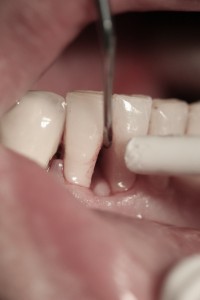 surgery-4-04