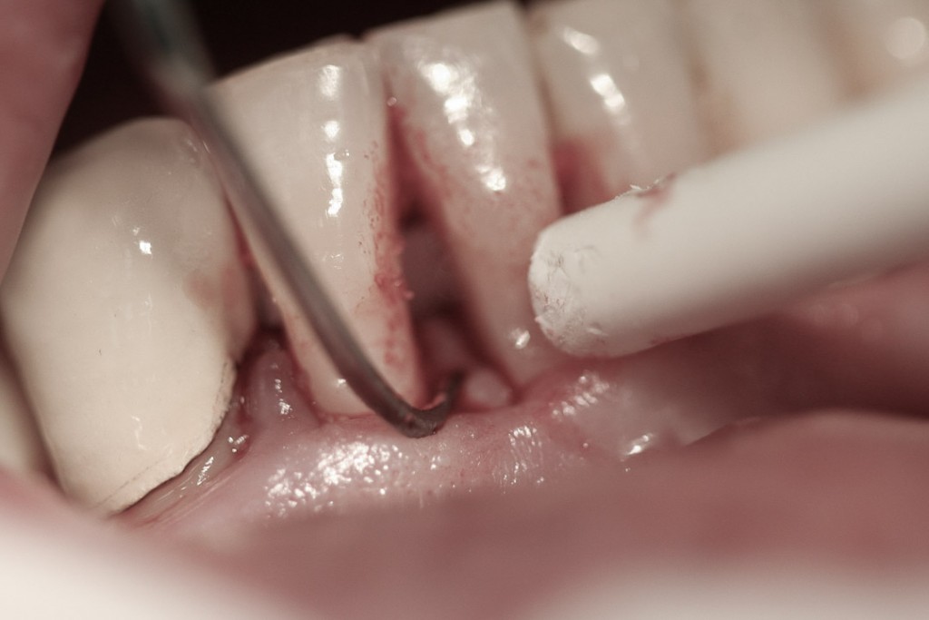 surgery-4-05